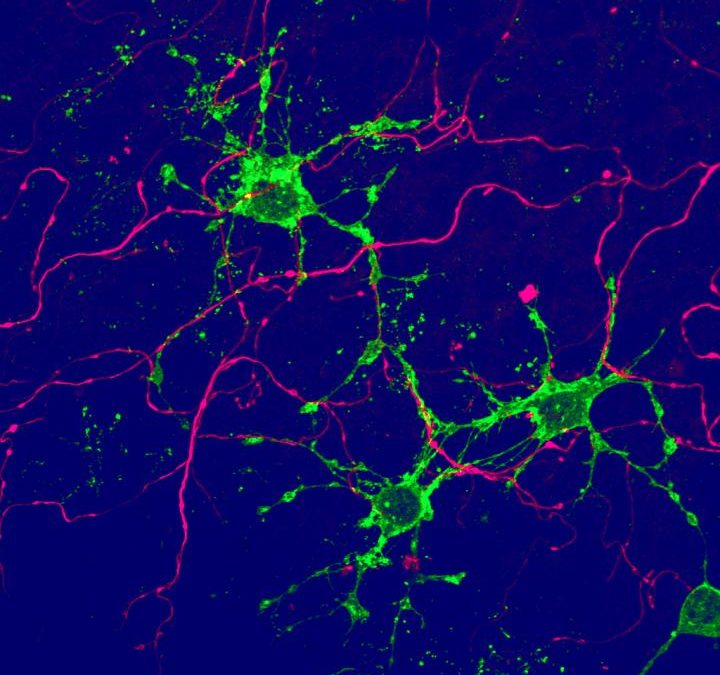 Scienza: scoperte nuove cellule gliali nel cervello