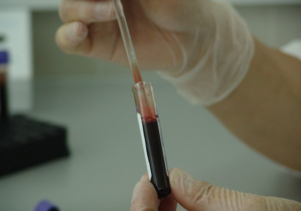 Leucemia: per sviluppo nuove terapie geniche meglio studiare microambiente