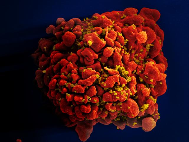 Nuova sperimentazione per un vaccino contro l’HIV