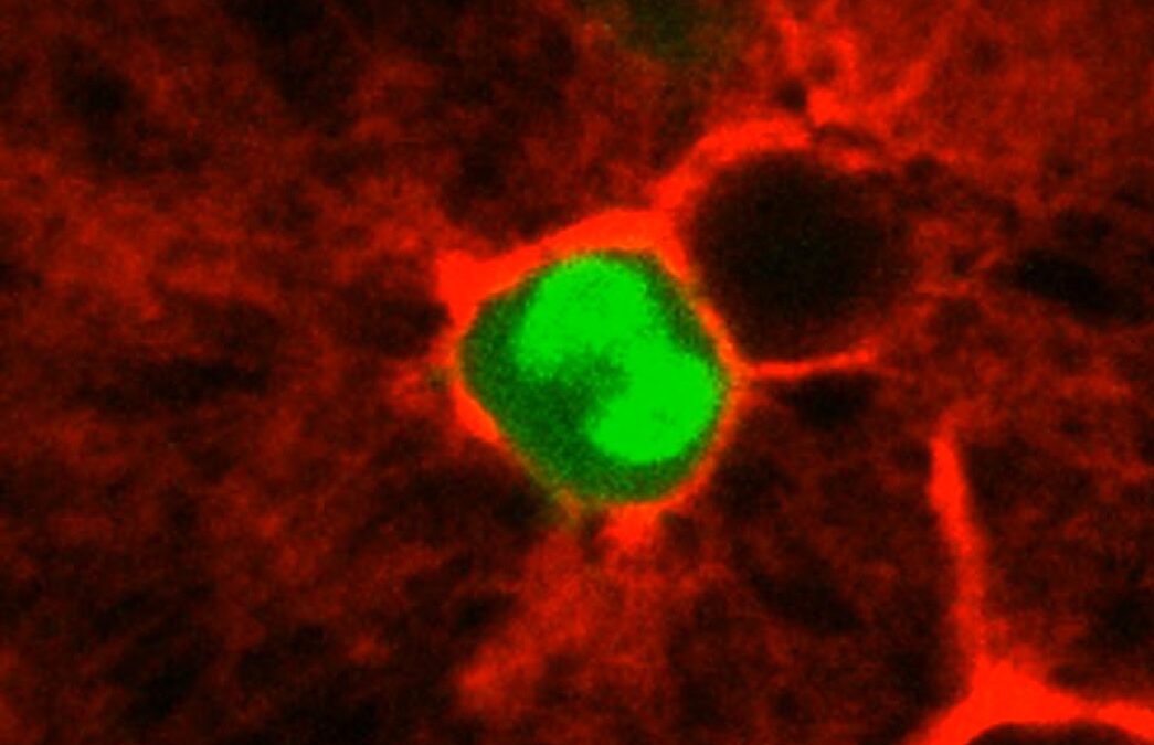 Salute: ecco come cellule cancerose formano le metastasi