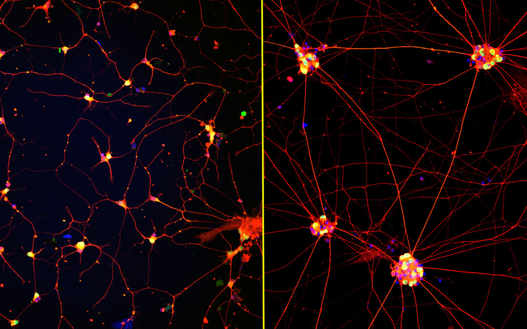 Creati primi neuroni maturi da cellule staminali, speranza di cura per Alzheimer 