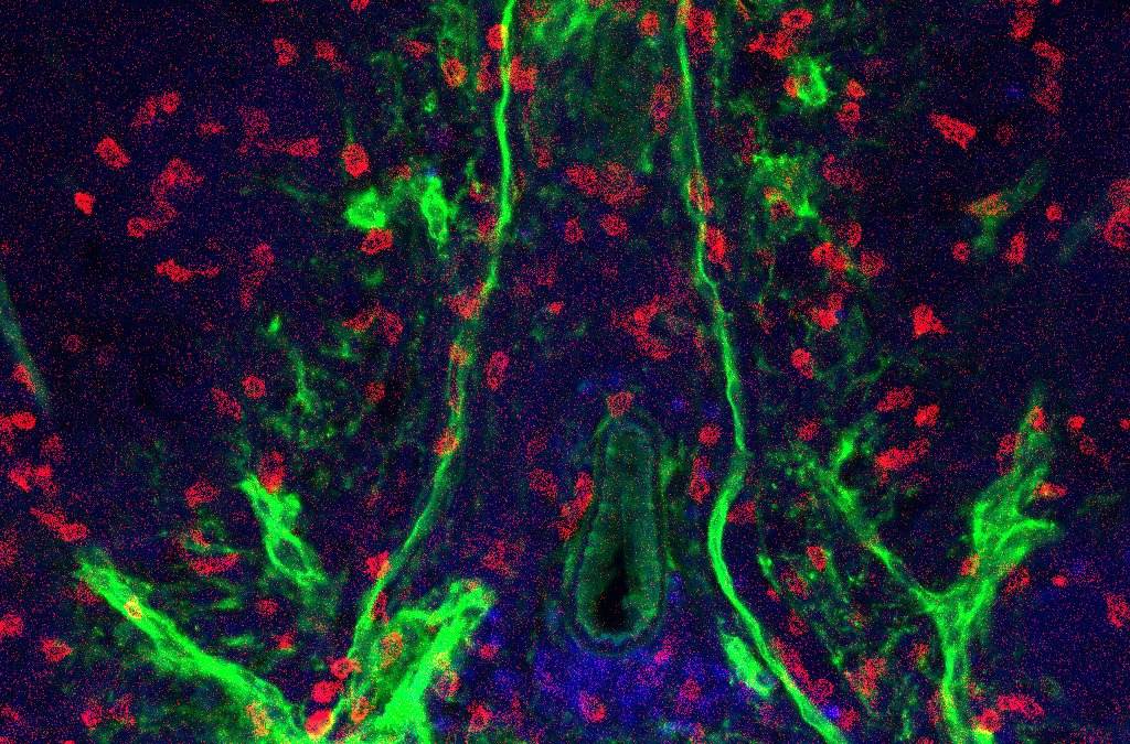 Curare la sclerosi multipla bloccando specifiche cellule nel sistema nervoso centrale