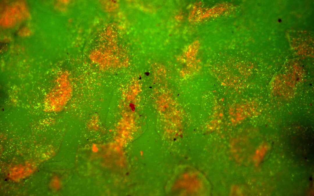 Humanitas, ricerca svela il ruolo chiave della micro-geometria delle protesi al seno