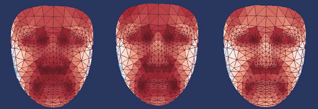 Malattie metaboliche, diagnosi precoce grazie alla temperatura del viso