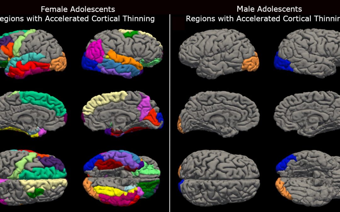 Covid: i lockdown hanno invecchiato il cervello degli adolescenti