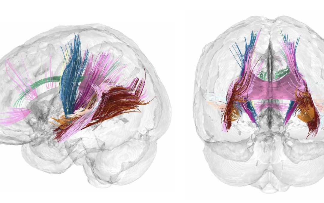 Scoperto come cambia il cervello durante la gravidanza