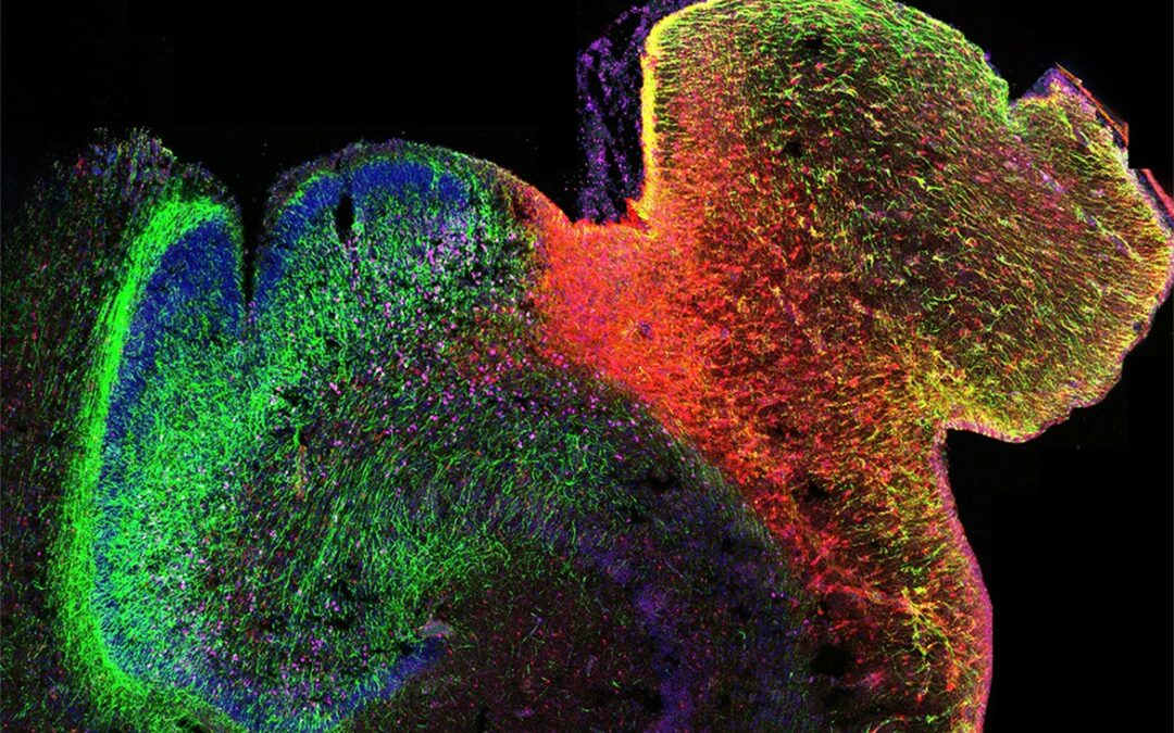 Prima mappa delle modifiche del DNA nel cervello umano in via di sviluppo