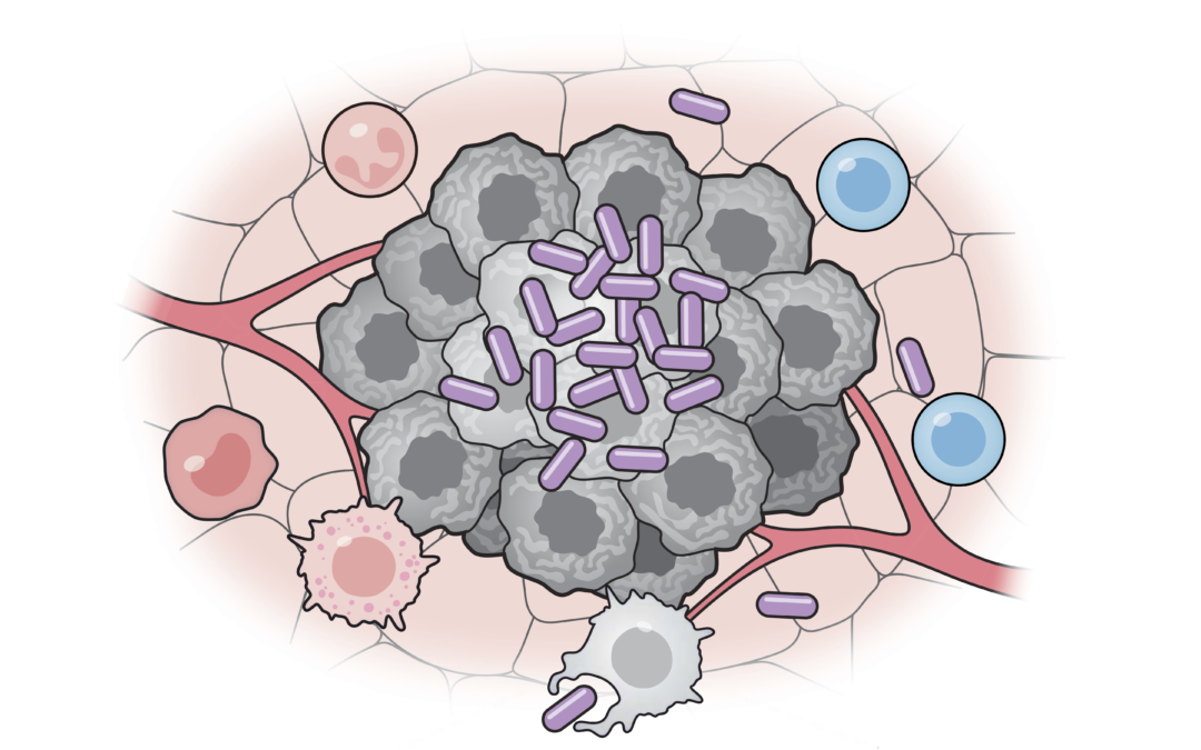 Vaccino batterico promettente come immunoterapia contro il cancro