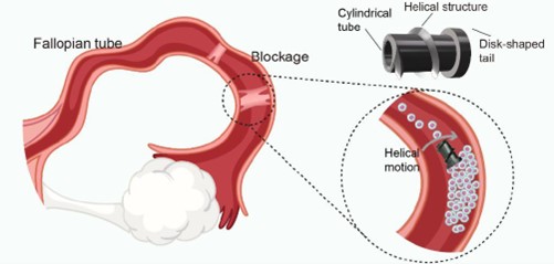 Microrobot per rivoluzionare i trattamenti dell’infertilità