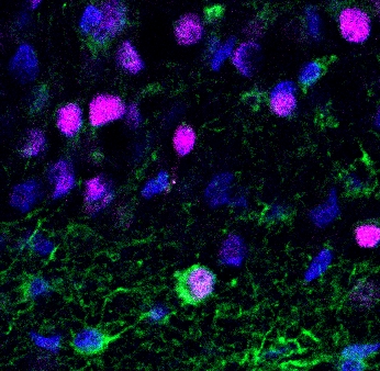 Neurogenesis