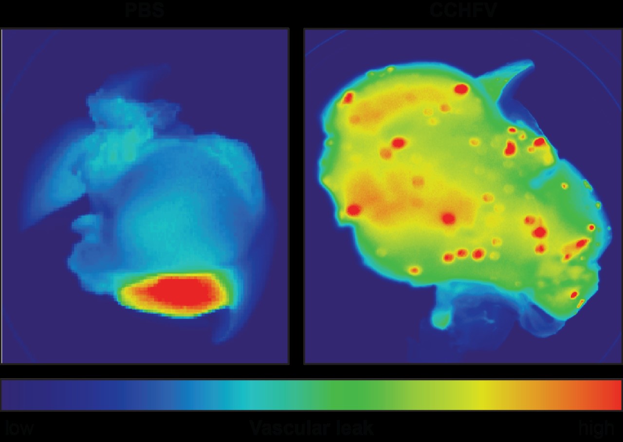 Figure 1B