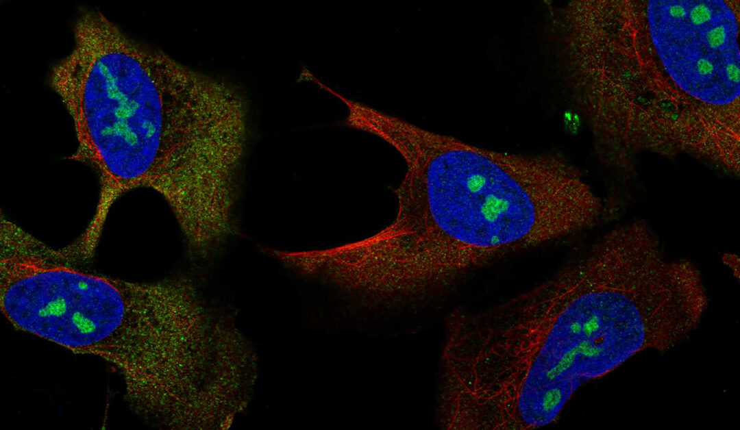 Svelata la mappa della cellula umana, un passo avanti nella comprensione delle cellule tumorali
