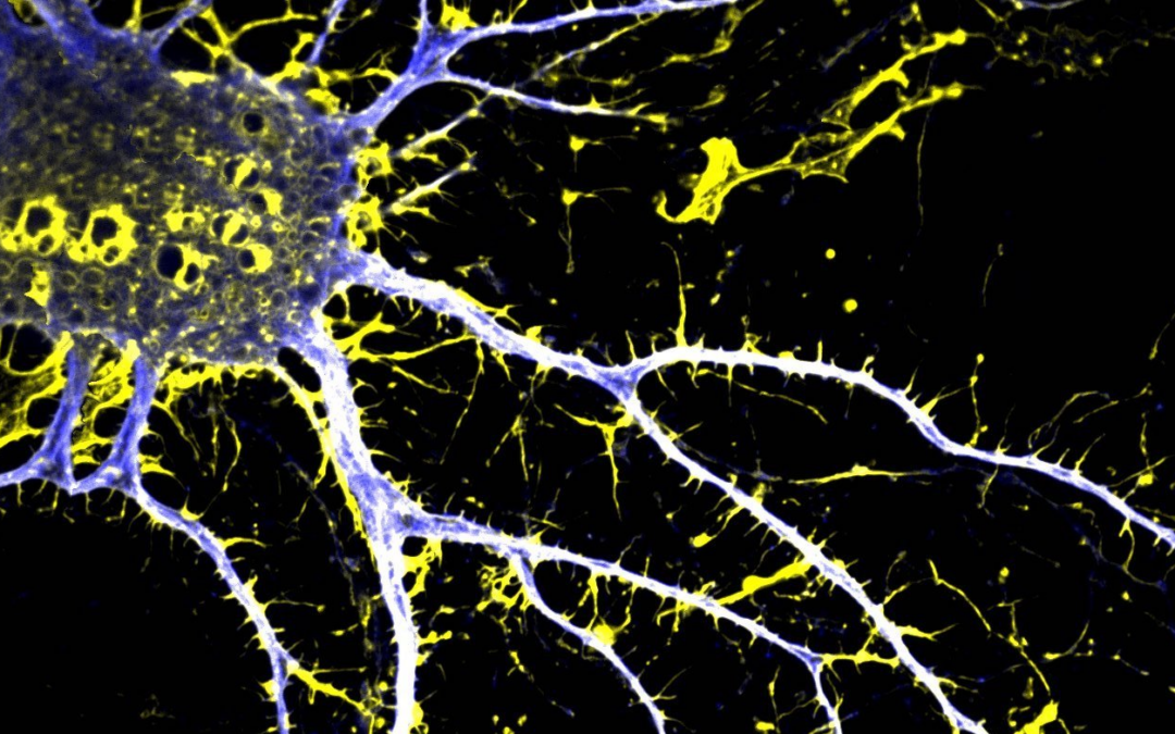 Nuovo approccio contro la schizofrenia