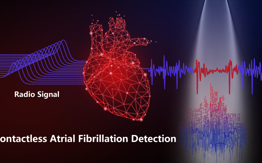 Nuova tecnica per rilevare l’aritmia senza contatto