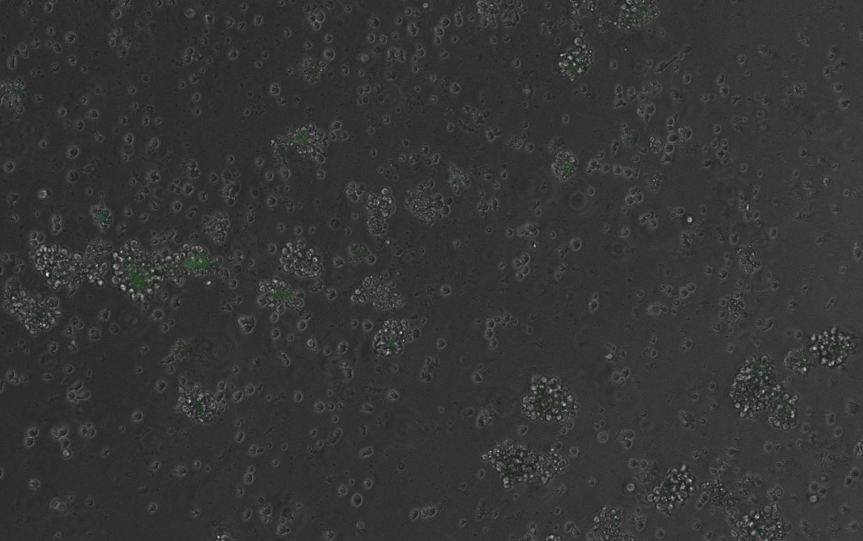 Fluorescent reporte gene activated in some cells