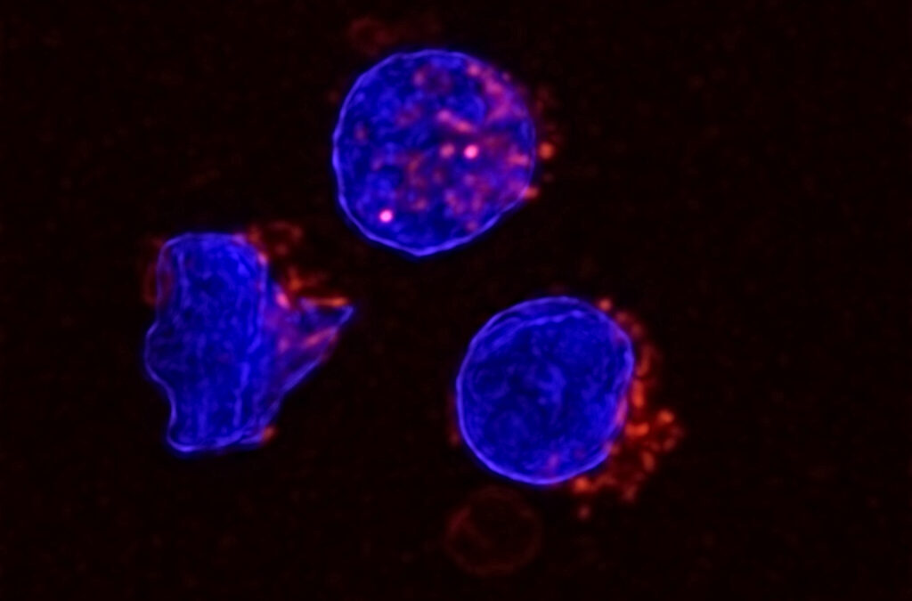 Tumori: il grasso addominale indebolisce il corpo contro il cancro