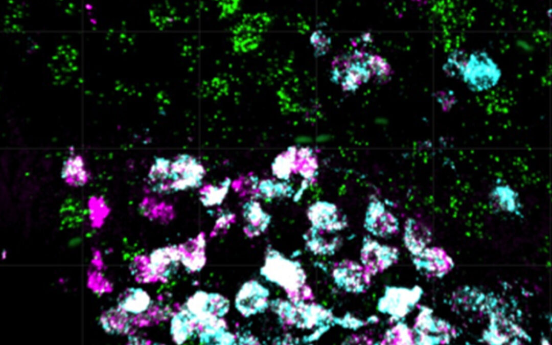 Scoperto nuovo gruppo di cellule nervose nel cervello che regola il peso corporeo