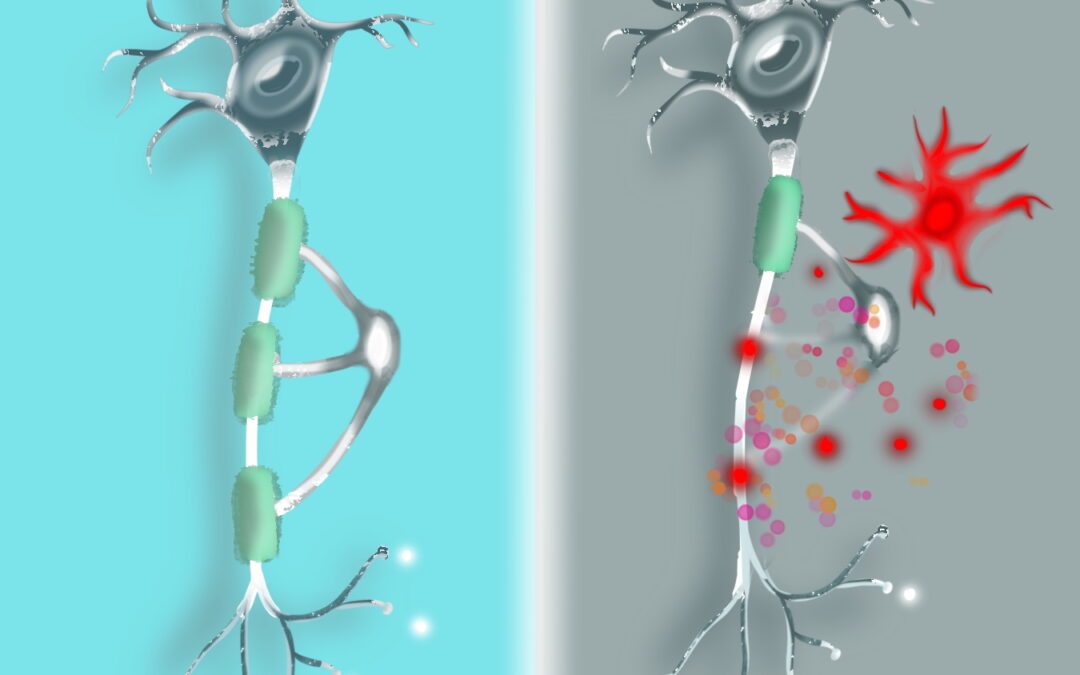 Tumori: terapia CAR-T provoca nebbia cerebrale