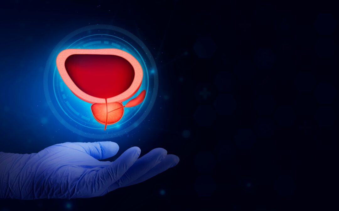Farmaco per il diabete come possibile trattamento per il cancro alla prostata