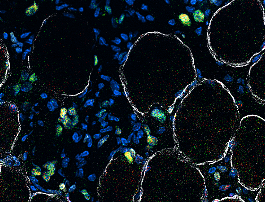 Il ripristino delle cellule staminali dei muscoli invecchiati porta al ringiovanimento