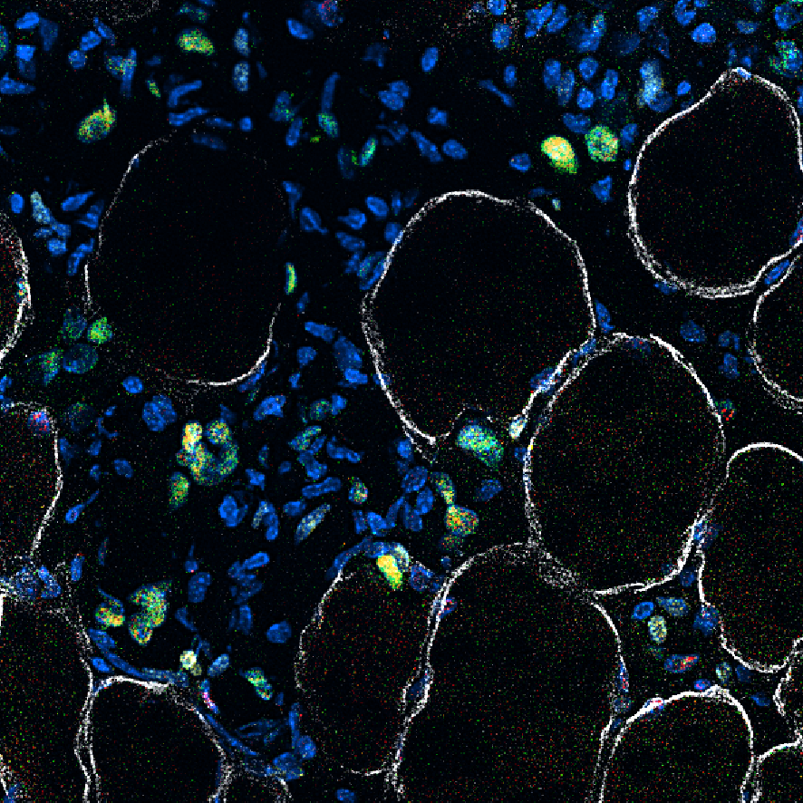 Muscle_DAPI_MyoDMyoGKi67DMD