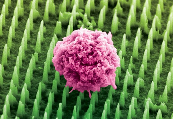 Tumori: decine di milioni di nanoaghi potrebbero sostituire le dolorose biopsie