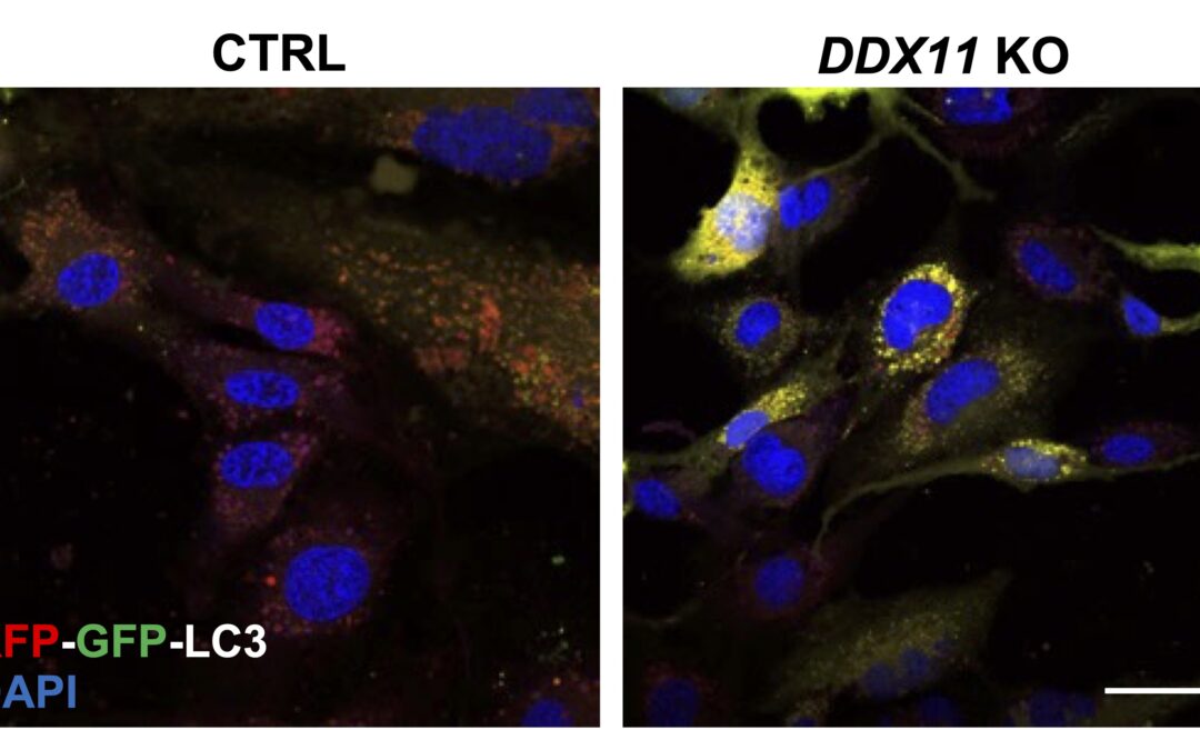 Dalla proteina che “pulisce” le cellule nuove speranze per malattie rare e neurodegenerative
