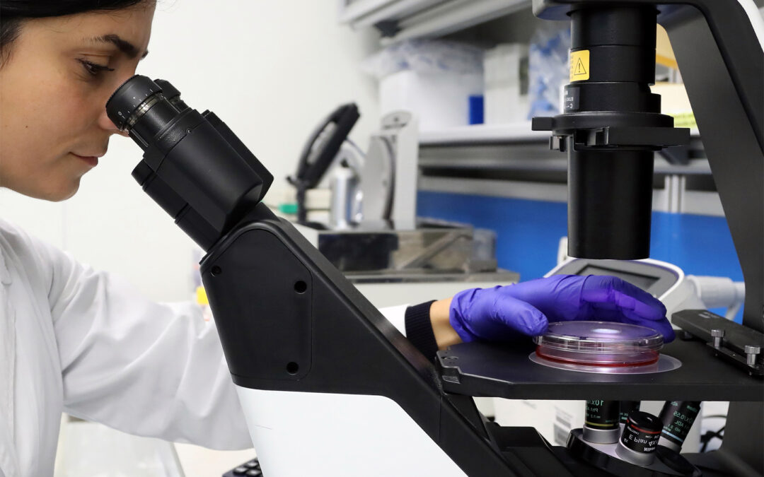 Artrite grave, scoperti difetti  silenziosi del sistema immunitario