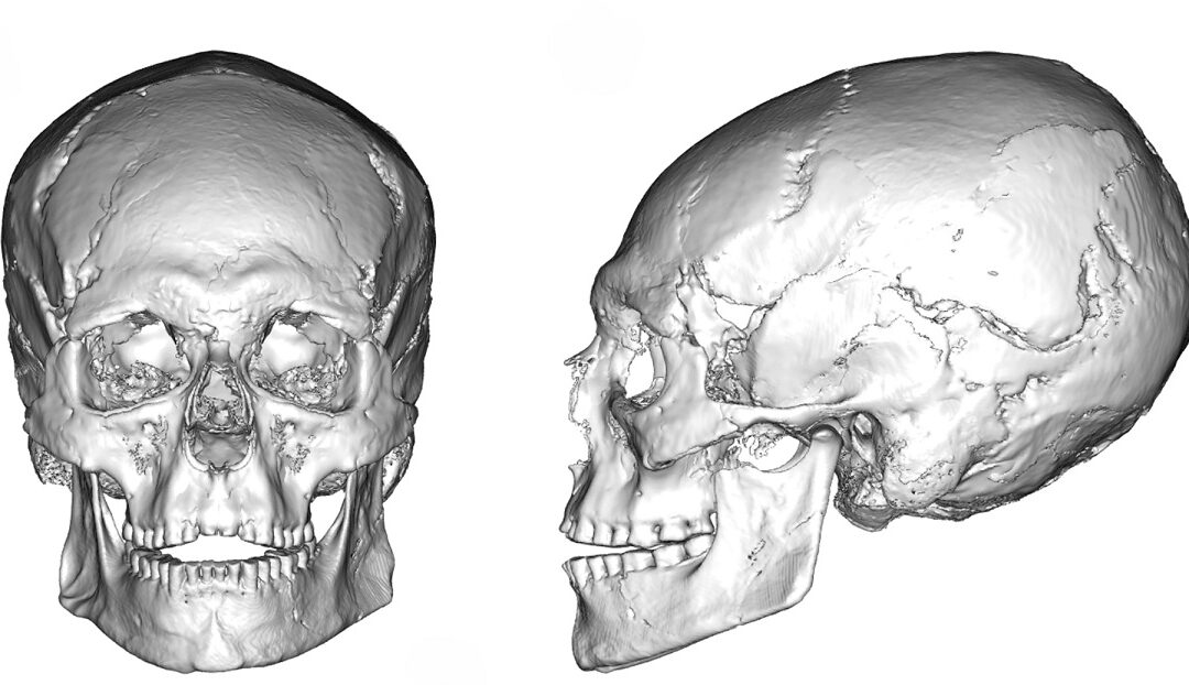 Scoperta in cranio di 12mila anni traccia di modificazione intenzionale