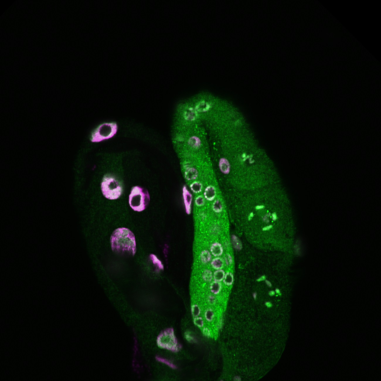 Histone2