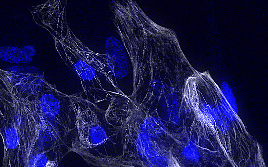 Scoperto un nuovo gene chiave per la salute del cuore