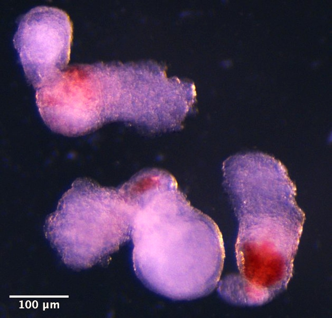 1. Day 14 hematoids.