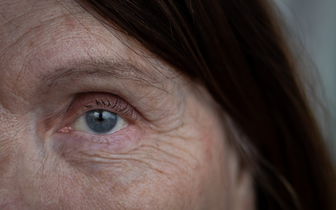 Nuova terapia mostra un potenziale blocco della degenerazione maculare secca