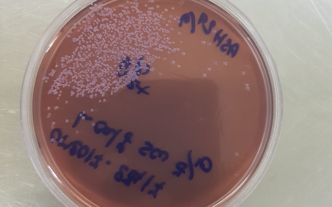 Allo studio un vaccino per le infezioni infantili