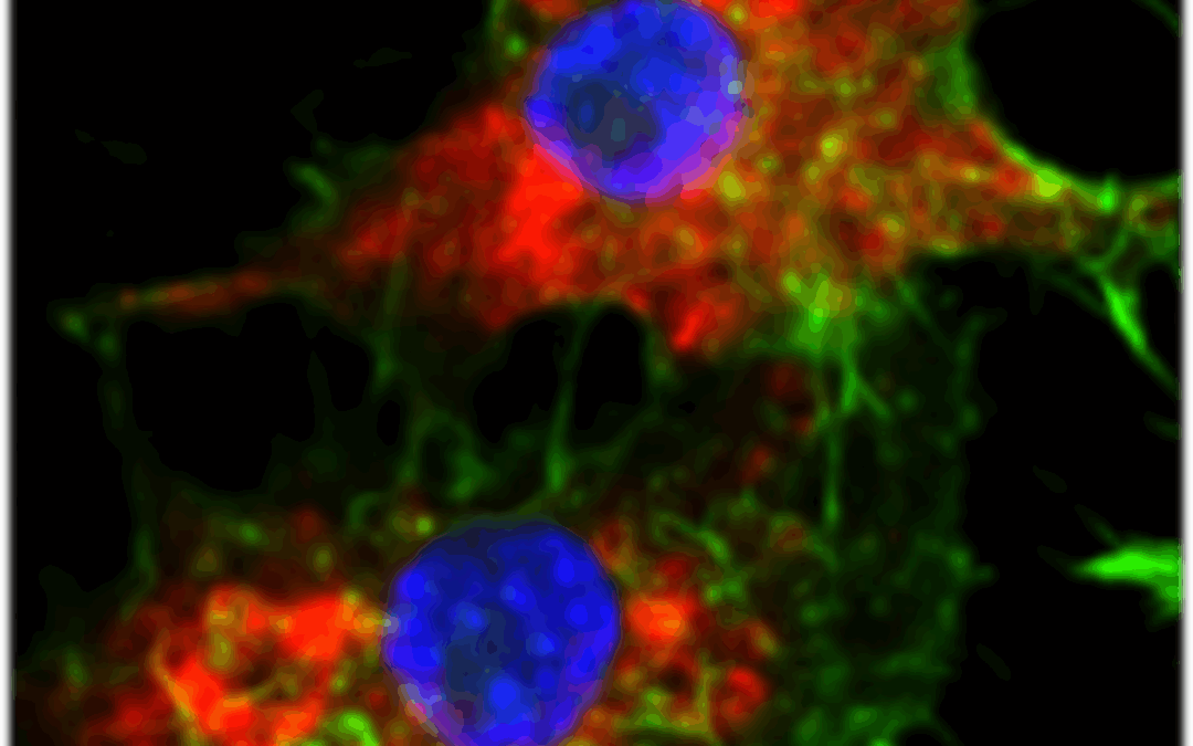 Tumori: nuova nanomedicina elimina la leucemia negli animali
