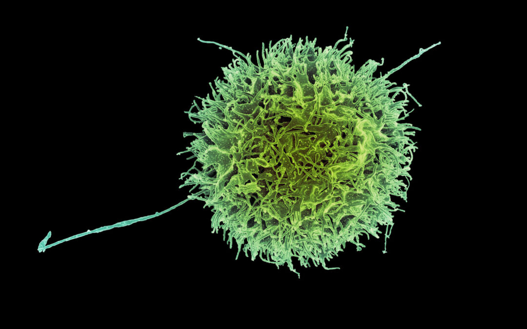Cellule “natural killer” ingegnerizzate potrebbero aiutare a combattere il cancro