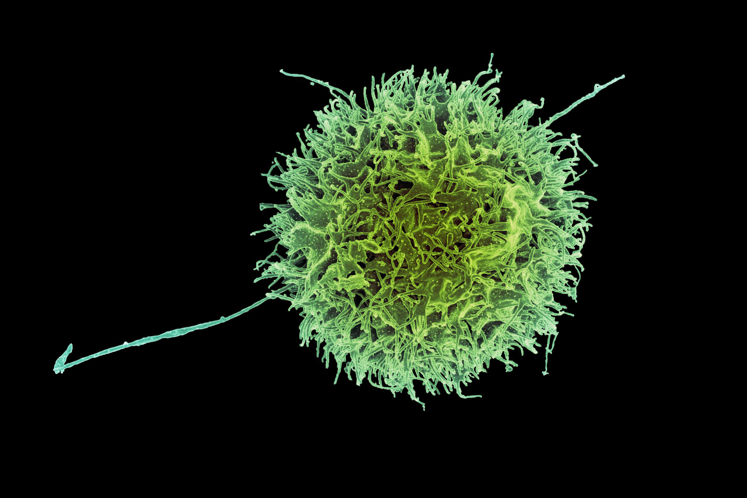 MIT-_Natural_Killer_Cell-01-press