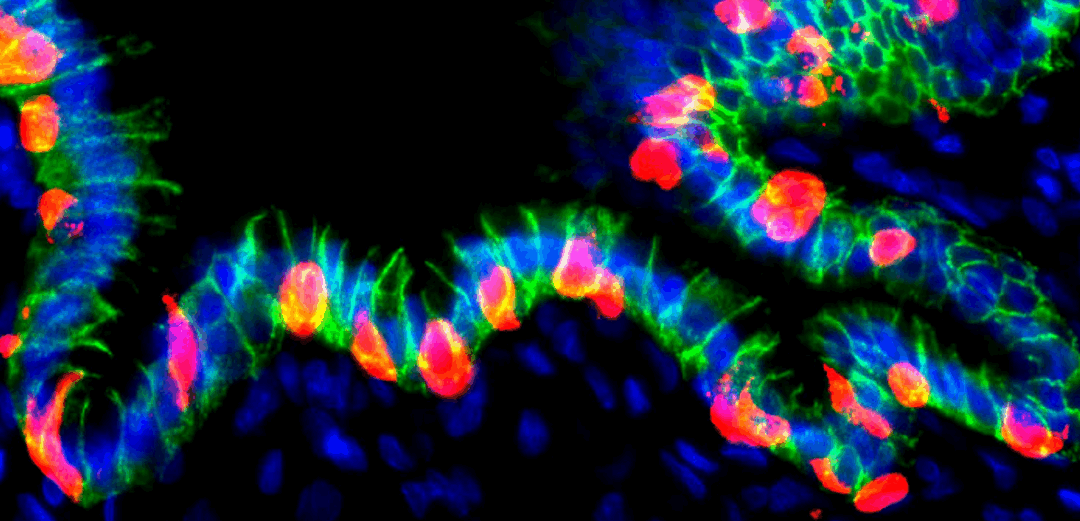 Cellule dello stomaco umano riprogrammate per produrre insulina